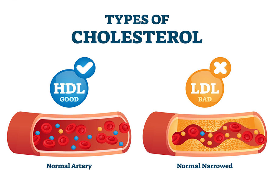 Debunking Cholesterol Myths with Greg McCoy